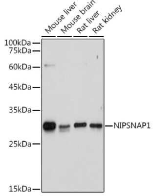 Western Blot: NIPSNAP1 AntibodyAzide and BSA Free [NBP3-05243]